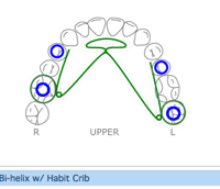 Build an orthodontics appliance